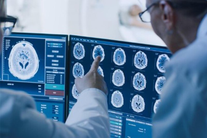 NEUROLOGY